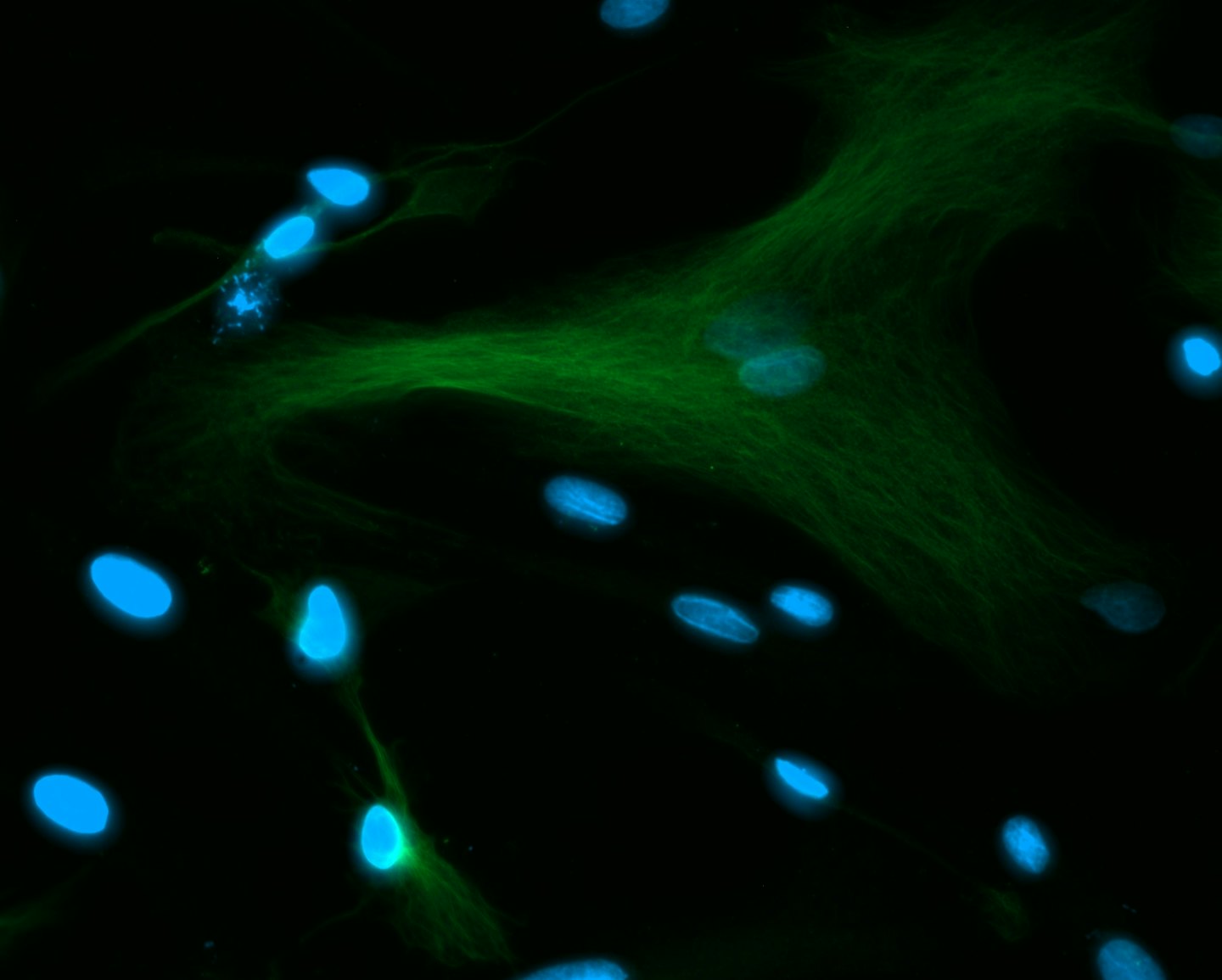 Microscope view of cells with blue nuclei and green fibrous networks.